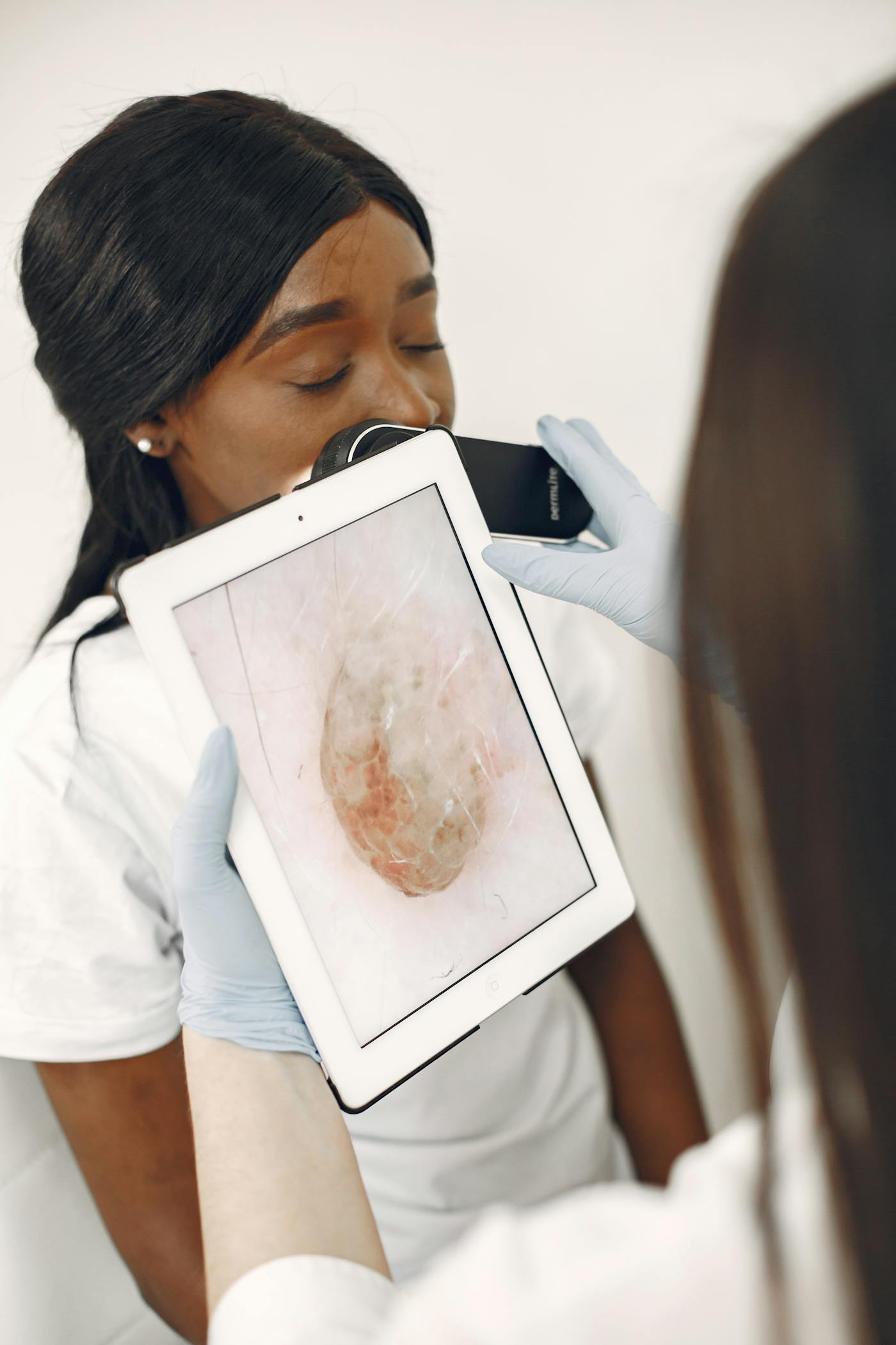 Check-up dermatológico