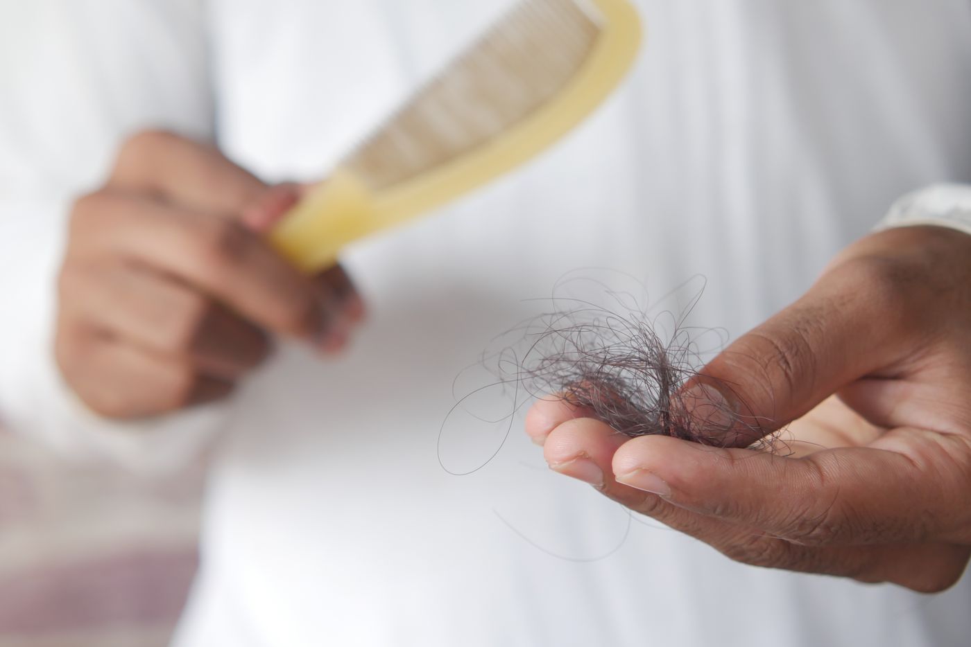 Queda de cabelo
